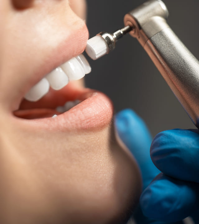 Closeup image of a dentist cleaning teeth