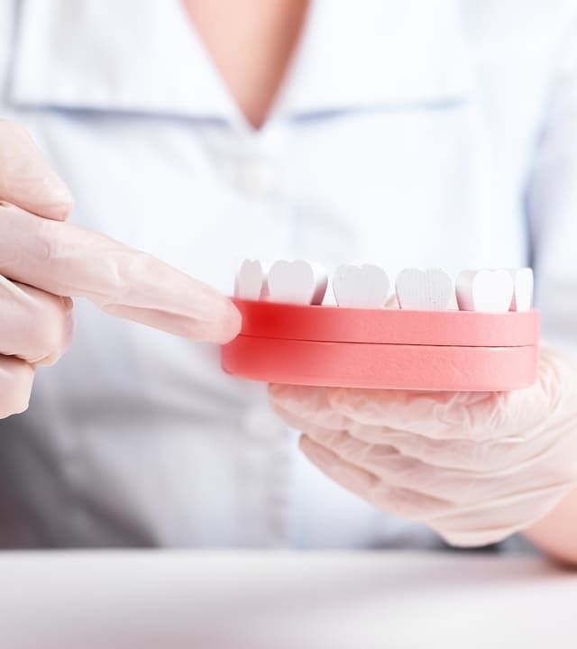 Dentist showing gingival inflammation at jaw model with teeth.