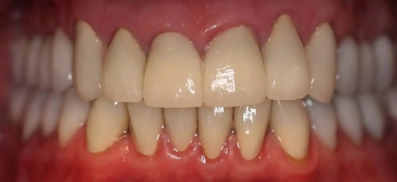 Before and After' Teeth Repair Results