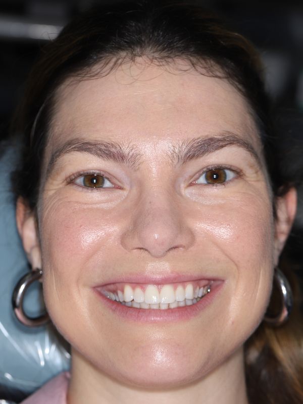 Slim Dental patient After procedure