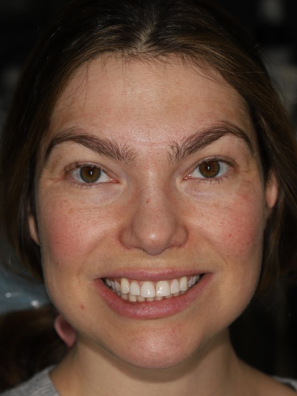 Slim Dental patient before procedure