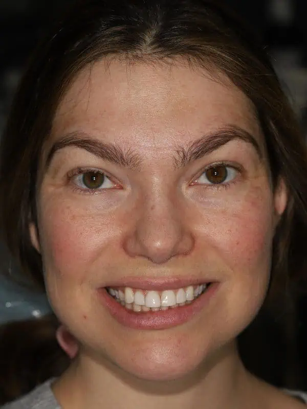 Slim Dental patient before procedure