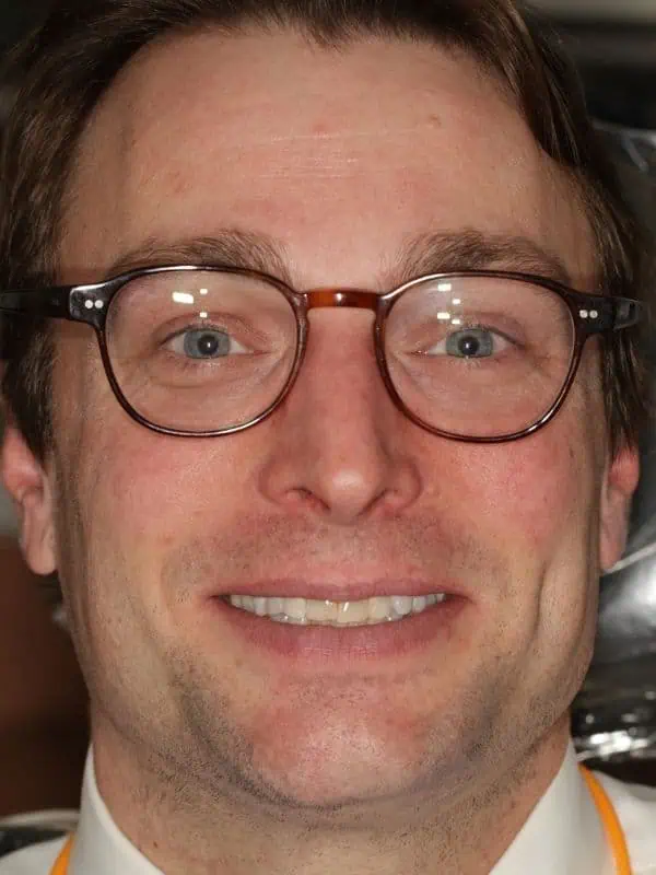 SLim Dental patient smiling before having smile makeover.