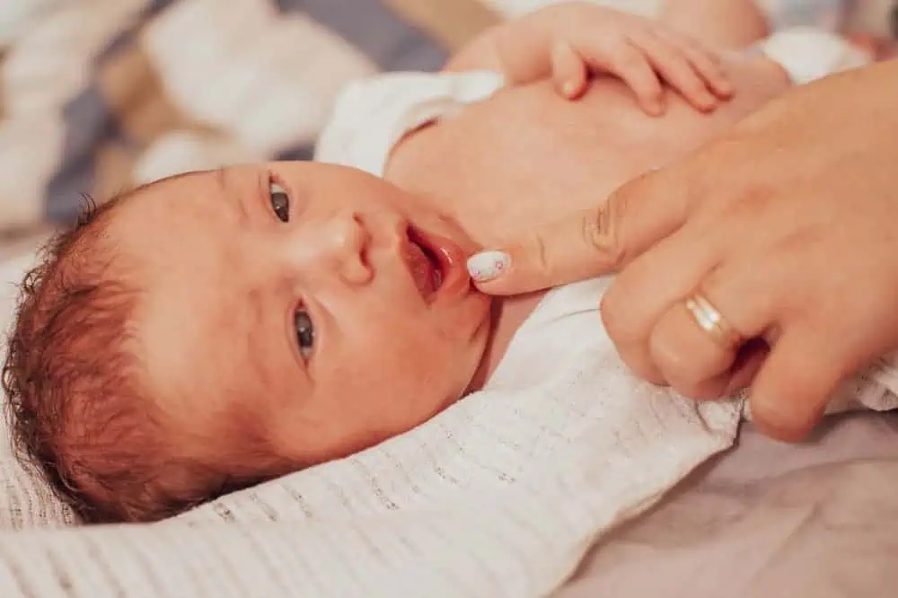 The examination of newborn baby mouth, frenulum of the tongue